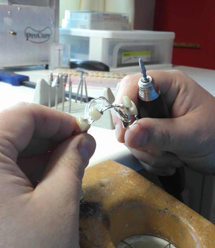 Dental Technician working on a set of dentures