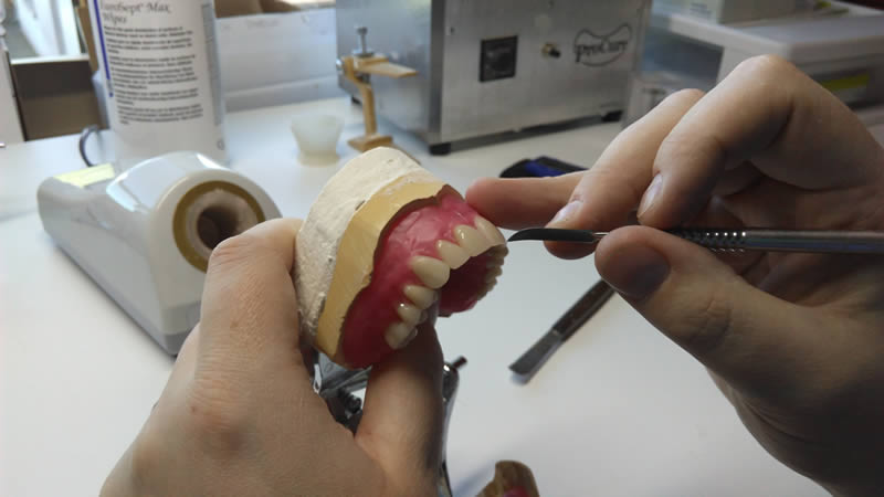 To achieve a relistic look, all dentures are sculpted by hand by Kevin.